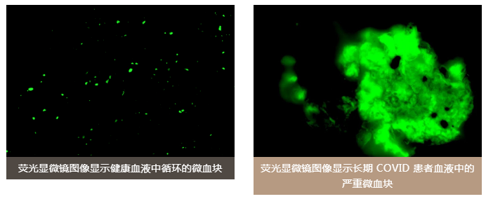 水蛭素、老年癡呆、前列腺、陽康