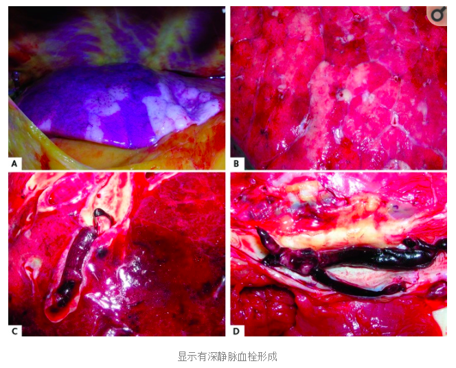 水蛭素、陽(yáng)康、烏梅、壯醫(yī)水蛭療法