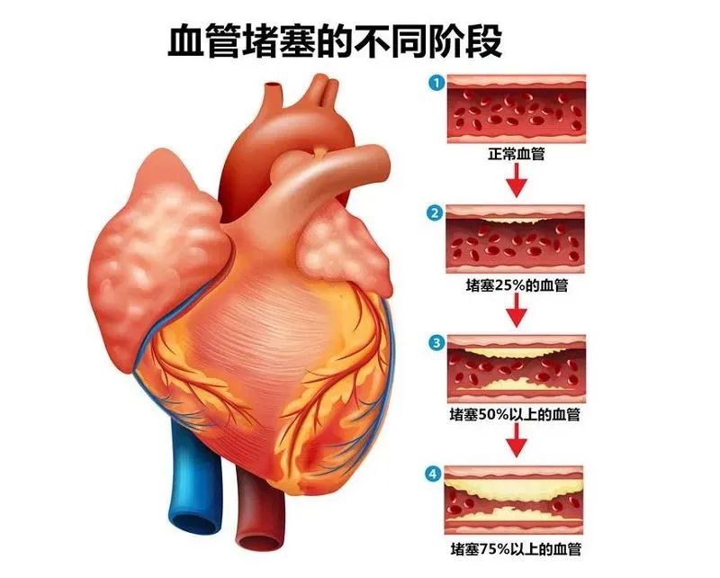 壯醫(yī)水蛭療法，天然水蛭素